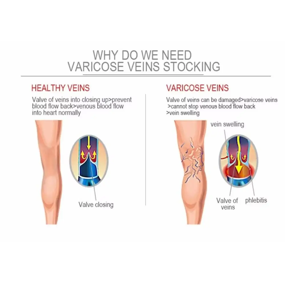Calcetines de compresión hasta la rodilla a la moda, calcetines elásticos de Color sólido con soporte para piernas, calcetines hasta la rodilla para mujeres y hombres