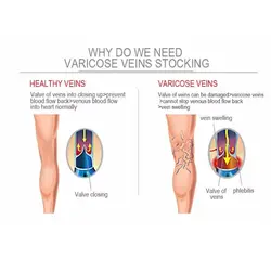 Calcetines de compresión hasta la rodilla a la moda, calcetines elásticos de Color sólido con soporte para piernas, calcetines hasta la rodilla para mujeres y hombres