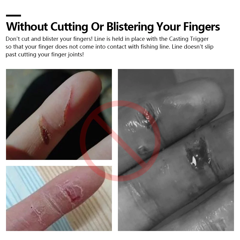 Triggers de lanzamiento de pesca antideslizantes, Clip de lanzamiento, botón de dedo pulgar, carrete fijo, ayuda para herramientas de pesca en la playa y el océano - imagen 5