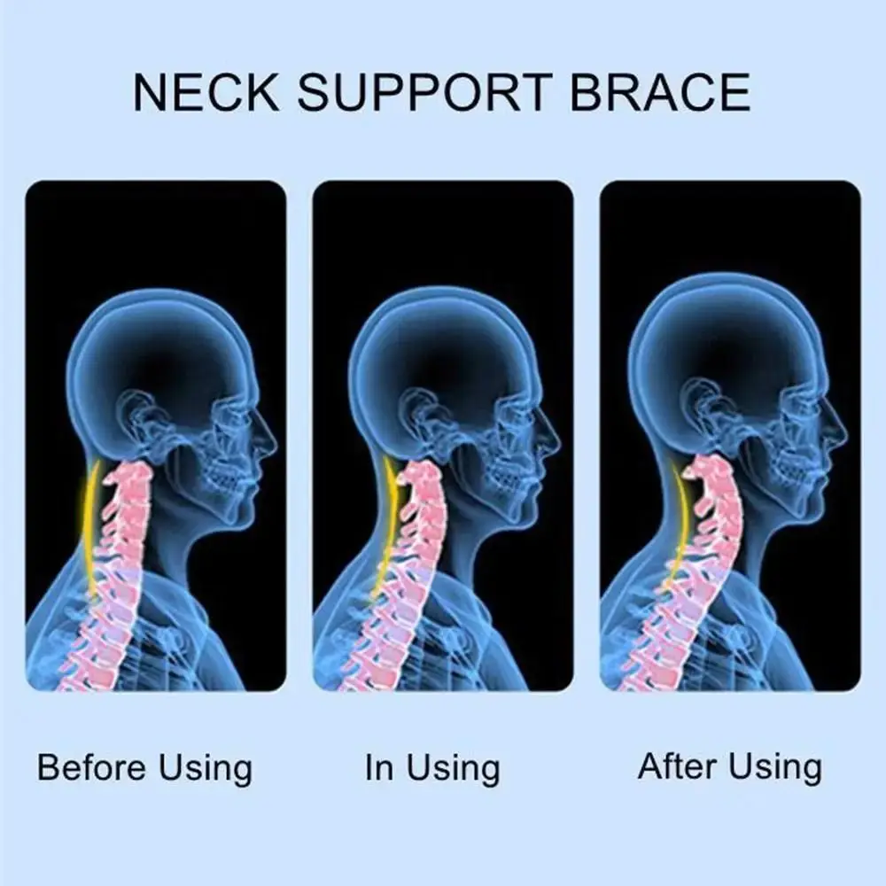 Collar cervical de espuma ajustable – Alivio del dolor de cuello - imagen 2