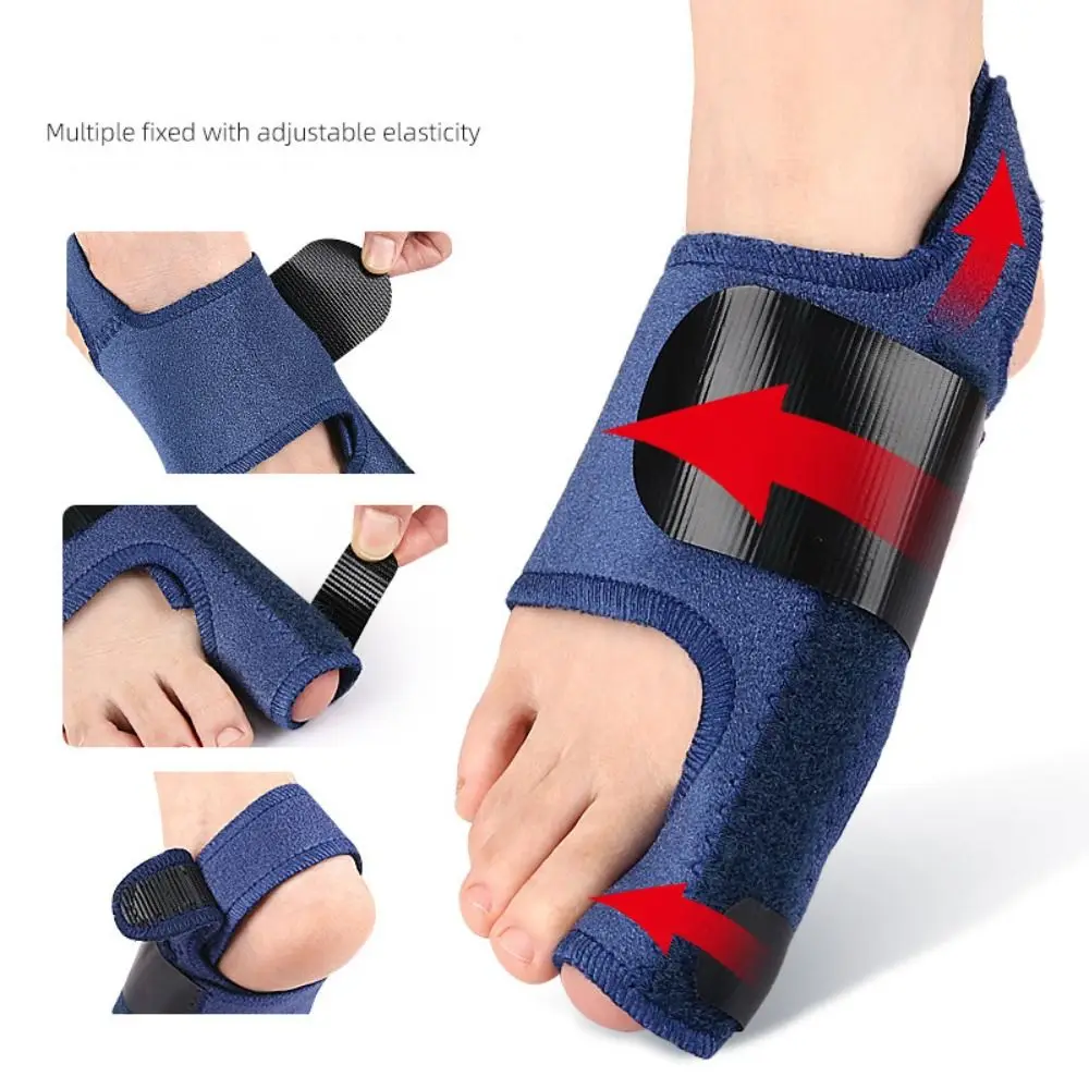 Corrector de valgo para pies, soporte ajustable para juanete, ajustador de pulgar Valgus, Protector de juanete, Corrector de juanete, Corrector de pulgar - imagen 3