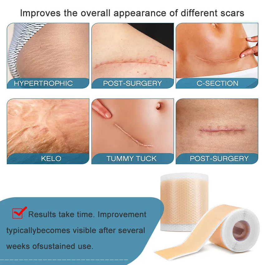 Un póster que muestra diferentes tipos de cicatrices y cómo se pueden mejorar