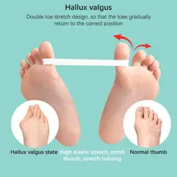 Separador de dedos de silicona para juanetes – Corrector de pies